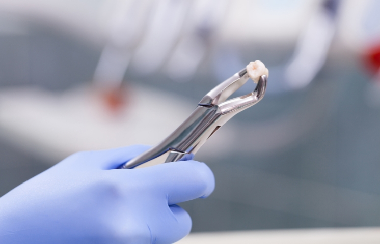 comprehensive idea about what you can eat after tooth extraction